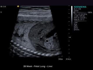 General Ultrasound Services at Diagnostic Imaging Specialists of Chicago